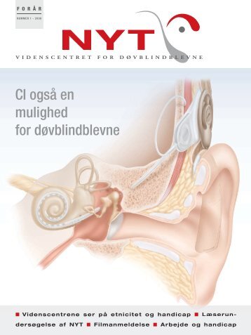 NYT om erhvervet døvblindhed 2008 nr. 1