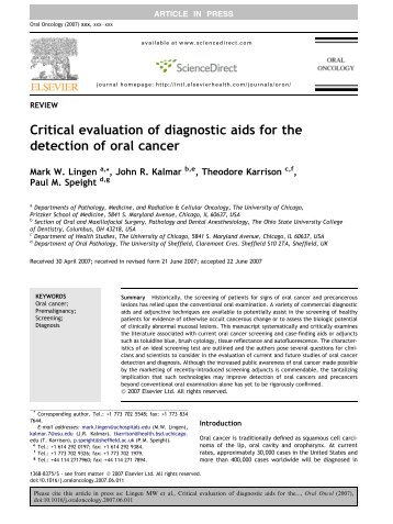 Critical evaluation of diagnostic aids for the detection of oral cancer