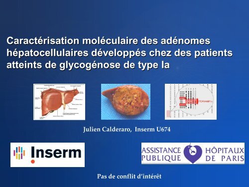 CaractÃ©risation molÃ©culaire des adÃ©nomes hÃ©patocellulaires ... - Afef