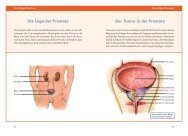 Die Lage der Prostata Der Tumor in der Prostata - ZS-Verlag