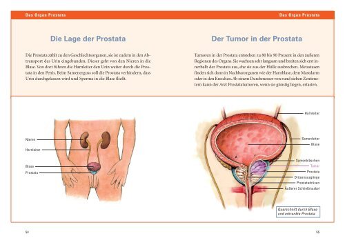 Die Lage der Prostata Der Tumor in der Prostata - ZS-Verlag