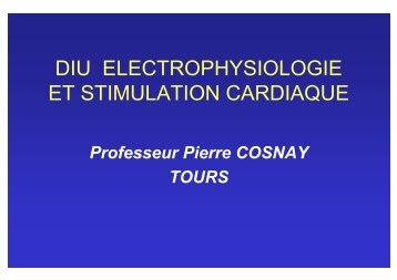 Traitements du signal ECG, Holter