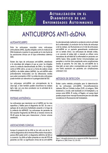 1- ANTICUERPOS ANTI-dsDNA