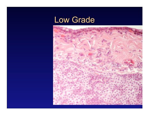 Retrospective evaluation of canine conjunctival mast cell tumors