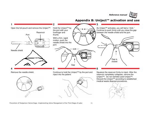 Implementing Active Management of the Third Stage of Labor