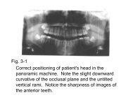 Fig. 3-1 Correct positioning of patient's head in the panoramic ...