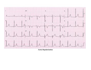 12-Lead ECG Examples - Grand County EMS