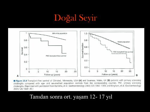 Primer Sklerozan Kolanjit ve Safra YollarÄ± Kanseri - Prof. Dr. Sadettin ...