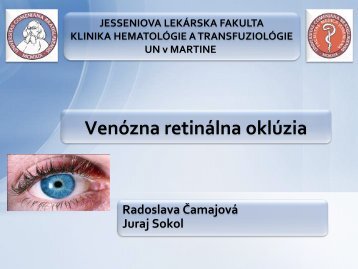 RetinÃ¡lna venÃ³zna oklÃºzia (RVO)