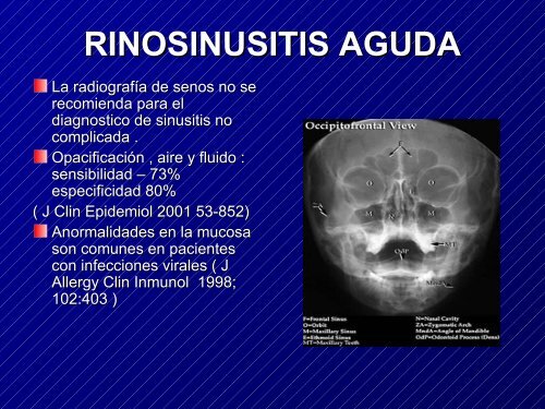 Neumonia de la Comunidad - Telmeds.org