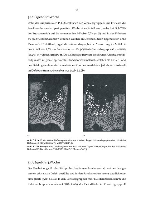 Ossäre Regeneration eines experimentellen critical-size Defektes ...