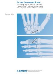 MatrixMANDIBLE Preformed Reconstruction Plates - Synthes