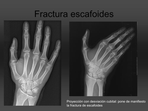 RADIOLOGÍA DE LA MANO