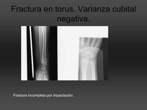 RADIOLOGÍA DE LA MANO