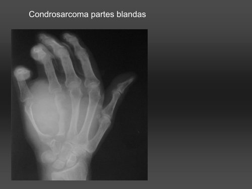 RADIOLOGÍA DE LA MANO