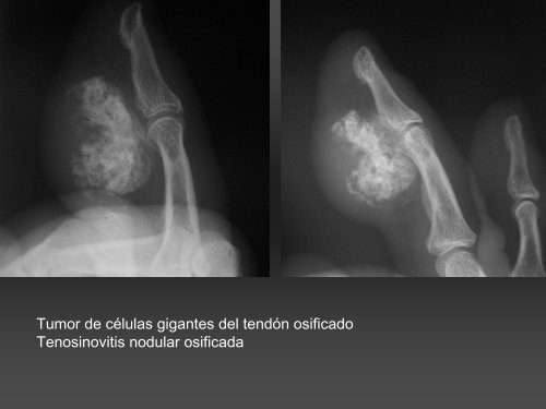 RADIOLOGÍA DE LA MANO