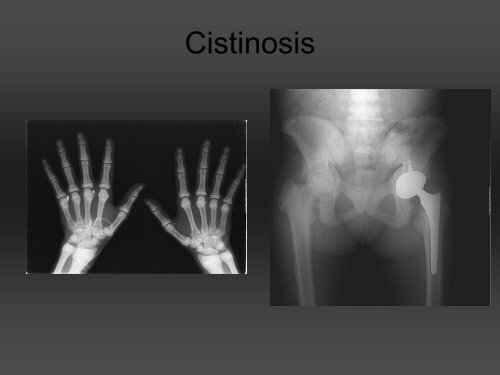 RADIOLOGÍA DE LA MANO