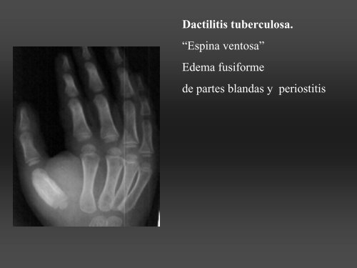 RADIOLOGÍA DE LA MANO