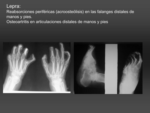 RADIOLOGÍA DE LA MANO