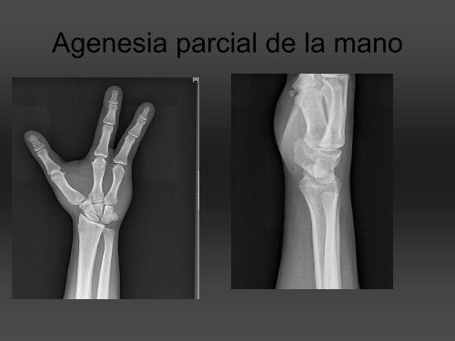 RADIOLOGÍA DE LA MANO