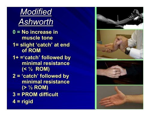 Modified Constraint-Induced Therapy