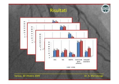 Angioplastica percutanea con stent delle lesioni di biforcazione ...