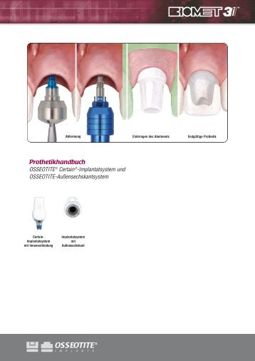 Prothetikhandbuch - BIOMET 3i