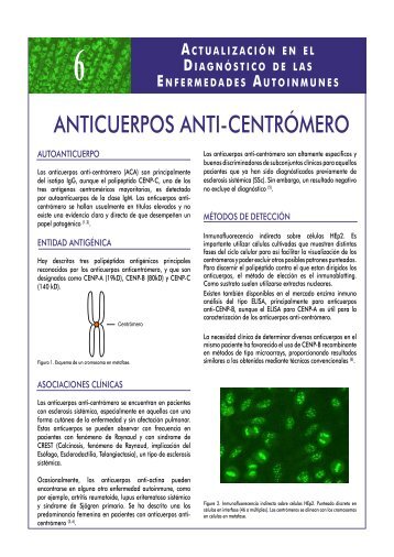 anticuerpos anti-centrómero