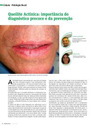 Queilite Actínica: importância do diagnóstico precoce e da prevenção