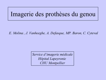 Imagerie des prothÃ¨ses du genou