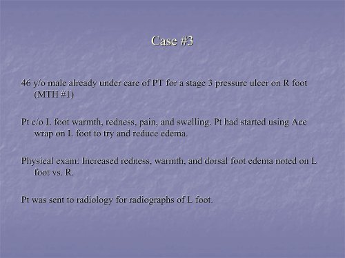 Acute Clinical Presentation of Charcot Arthropathy