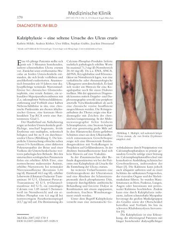 Kalziphylaxie â€“ eine seltene Ursache des Ulcus cruris - Springer
