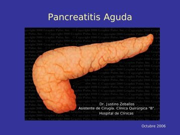 Pancreatitis Aguda - Hospital de ClÃ­nicas