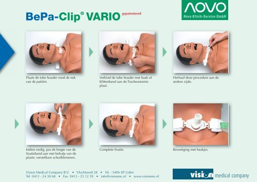 Fixatiemateriaal BePa-Clip - Vision Medical Company BV