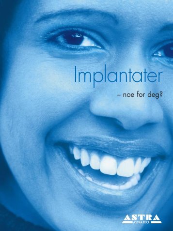 Implantater - Astra Tech