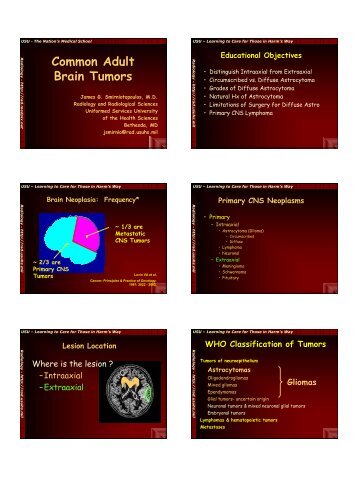 Common Adult Brain Tumors - Radiology - Uniformed Services ...