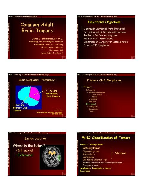 Common Adult Brain Tumors - Radiology - Uniformed Services ...