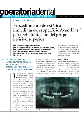 Procedimiento de estÃ©tica inmediata con superficie Avantblast ...