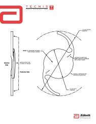 Anterior Side Posterior Side - TECNIS® Aspheric IOLs