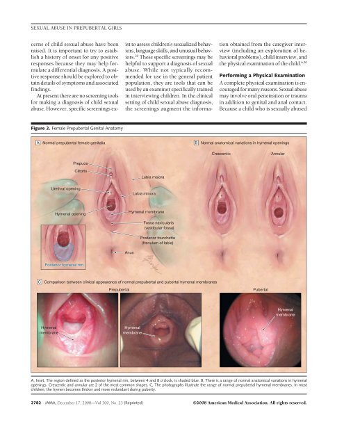 PDF) Differential attachment responses of male and female infants