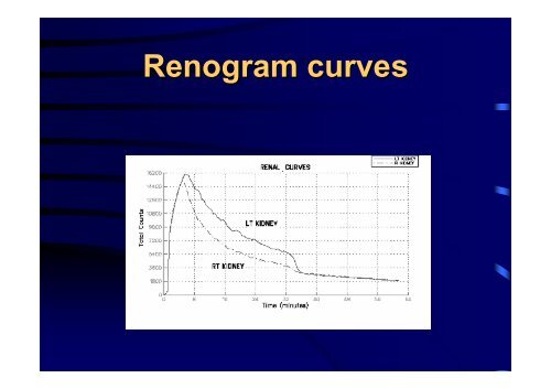 Diuretic Renal Scan Interpretation