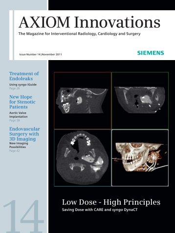 AXIOM Innovations November 2011 3.96MB - Siemens Healthcare