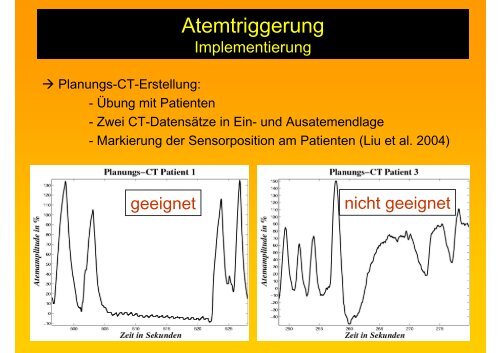 Atemtriggerung - Strahlentherapie