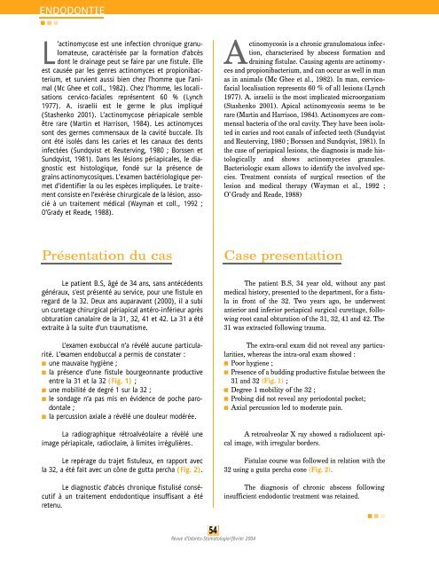 Actinomycose pÃ©riapicale : Ã  propos d'un cas. - SOP