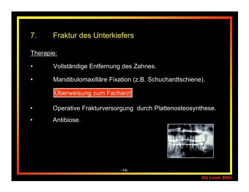 Komplikationen bei der Zahnextraktion