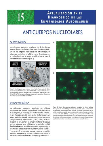 15-anticuerpos nucleolares - Biolinker.com.ar
