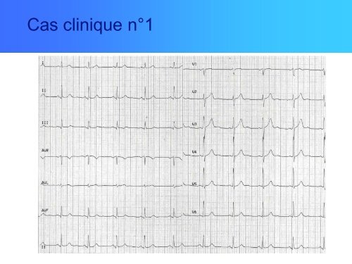 ClOpidogrel - bienvenue sur le site de l'amiform