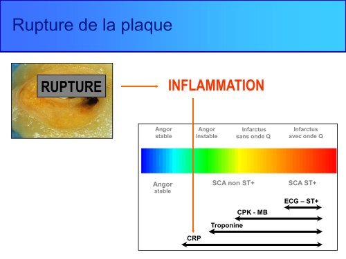 ClOpidogrel - bienvenue sur le site de l'amiform