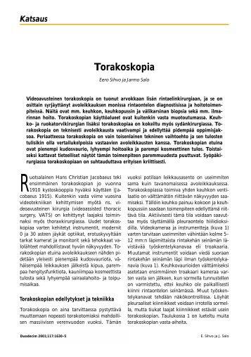 Torakoskopia - Terveyskirjasto