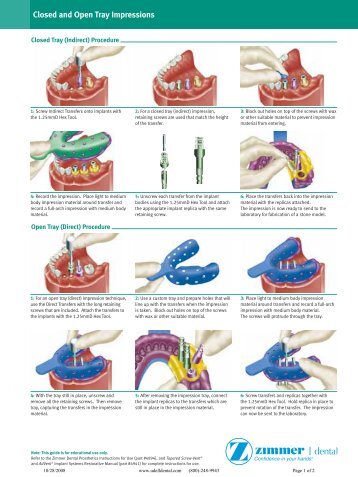 Zimmer Closed Open Impression - Udell dental laboratory